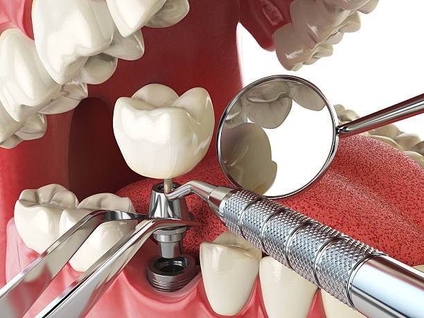 Best Emergency TMJ Treatment in Mendota, IL